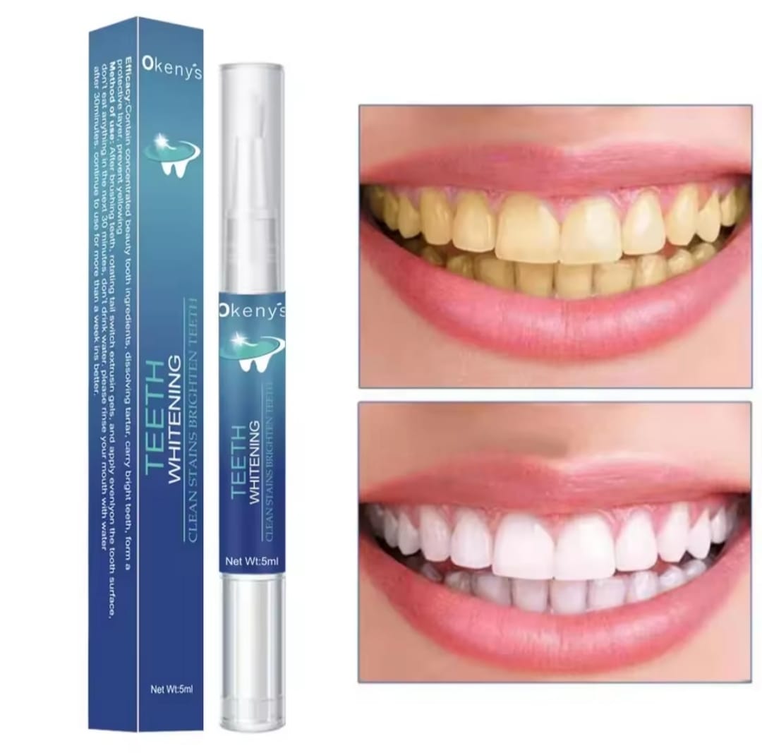 LAPIZ BLANQUEADOR DENTAL PROFESIONAL - ELIMINACION DE MANCHAS Y DIENTES MAS BLANCOS