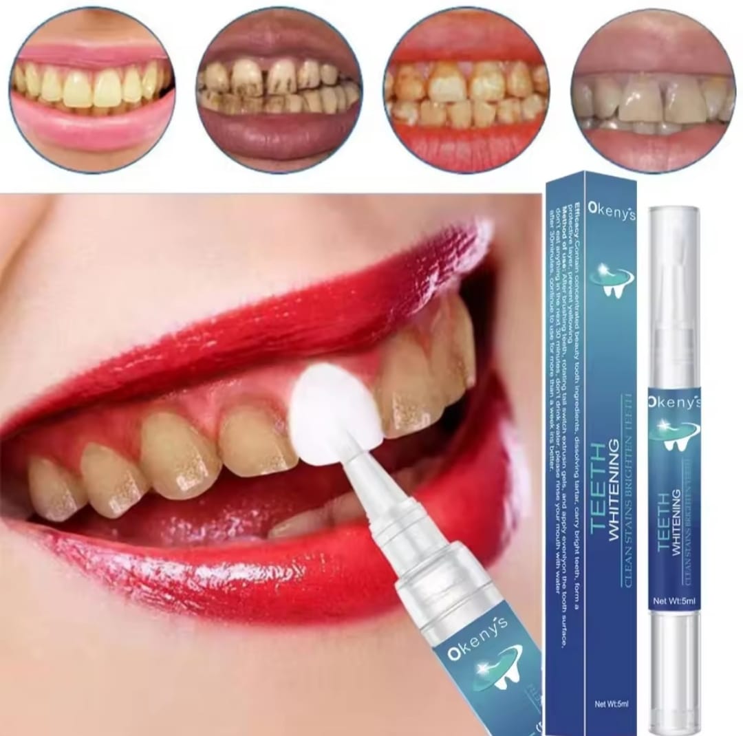 LAPIZ BLANQUEADOR DENTAL PROFESIONAL - ELIMINACION DE MANCHAS Y DIENTES MAS BLANCOS